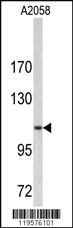 Anti-COL6A1 Rabbit Polyclonal Antibody