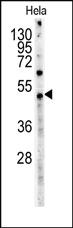 Anti-Myc Tag Mouse Monoclonal Antibody