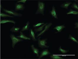 Anti-CRY2 Mouse Monoclonal Antibody [clone: 3H4]