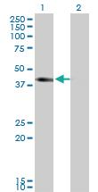 Anti-SLC12A1 Mouse Monoclonal Antibody [clone: 4H4]