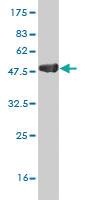 Anti-LEF1 Mouse Monoclonal Antibody [clone: 2C9]