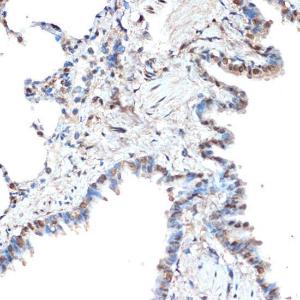 Immunohistochemistry analysis of paraffin-embedded rat lung using Anti-CoREST Antibody [ARC2044] (A307585) at a dilution of 1:100 (40x lens). Perform microwave antigen retrieval with 10 mM Tris/EDTA buffer pH 9.0 before commencing with IHC staining protocol.