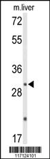 Anti-DUSP2 Rabbit Polyclonal Antibody