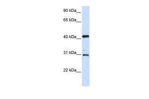 Anti-AURKA Rabbit Polyclonal Antibody