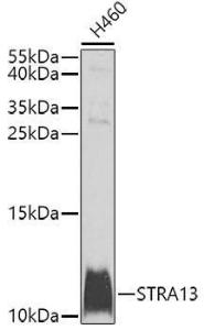 Western blot analysis of extracts of H460 cells, using Anti-MHF2 Antibody (A10828) at 1:1,000 dilution. The secondary antibody was Goat Anti-Rabbit IgG H&L Antibody (HRP) at 1:10,000 dilution.