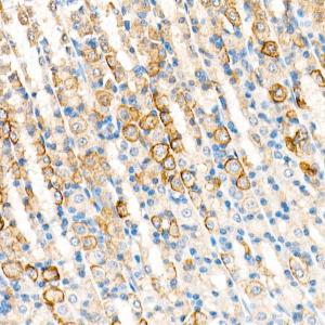 Immunohistochemistry analysis of paraffin-embedded rat stomach using Anti-Cytokeratin 19 Antibody [ARC0272] (A308569) at a dilution of 1:100 (40x lens) Perform microwave antigen retrieval with 10 mM PBS buffer pH 72 before commencing with IHC staining protocol