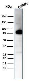 Western blot analysis of human ovary tissue lysate using Anti-Caldesmon Antibody [CALD1/7024R]