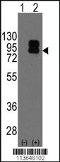 Anti-S100A4 Rabbit Polyclonal Antibody