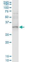 Anti-SULT1A1 Polyclonal Antibody Pair