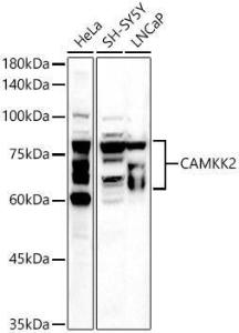 Anti-CAMKK2 Rabbit Polyclonal Antibody