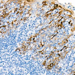 Immunohistochemistry analysis of paraffin-embedded human tonsil using Anti-Cytokeratin 19 Antibody [ARC0272] (A308569) at a dilution of 1:100 (40x lens) Perform microwave antigen retrieval with 10 mM PBS buffer pH 72 before commencing with IHC staining protocol