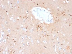 Immunohistochemical analysis of formalin-fixed, paraffin-embedded human brain using Anti-Ubiquitin Antibody [UBB/2122]