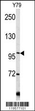 Anti-COL6A1 Rabbit Polyclonal Antibody