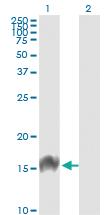 Anti-FABP4 Mouse Monoclonal Antibody [clone: 2H3-1G10]