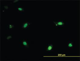 Anti-IRX3 Mouse Monoclonal Antibody [clone: 3D8]