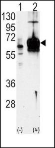 Anti-GUCY1A3 Rabbit Polyclonal Antibody