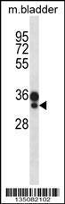 Anti-HOXC9 Rabbit Polyclonal Antibody