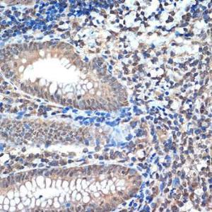 Immunohistochemistry analysis of paraffin-embedded human appendix tissue using Anti-CoREST Antibody [ARC2044] (A307585) at a dilution of 1:100 (40x lens). Perform microwave antigen retrieval with 10 mM Tris/EDTA buffer pH 9.0 before commencing with IHC staining protocol.