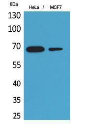 Western blot analysis of HeLa, MCF7 cells using Anti-PCK1 Antibody