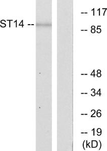 Western blot analysis of lysates from A549 cells using Anti-ST14 Antibody. The right hand lane represents a negative control, where the Antibody is blocked by the immunising peptide