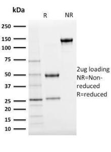 SDS-PAGE analysis of Anti-Ubiquitin Antibody [UBB/2122] under non-reduced and reduced conditions; showing intact IgG and intact heavy and light chains, respectively. SDS-PAGE analysis confirms the integrity and purity of the antibody