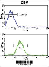 Anti-S100A4 Rabbit Polyclonal Antibody