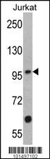 Anti-MUSK Rabbit Polyclonal Antibody