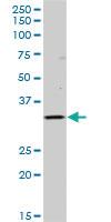 Anti-HLA-DOB Mouse Polyclonal Antibody