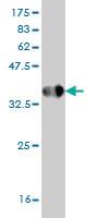 Anti-HPSE1 Mouse Monoclonal Antibody [clone: 4D7]