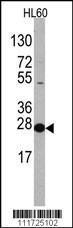 Anti-EIF4E Rabbit Polyclonal Antibody (HRP (Horseradish Peroxidase))