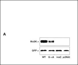 Anti-MUSK Rabbit Polyclonal Antibody