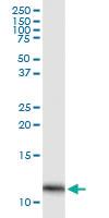 Anti-FABP4 Mouse Monoclonal Antibody [clone: 2H3-1G10]