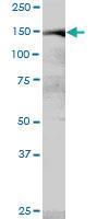 Anti-MYBBP1A Mouse Polyclonal Antibody