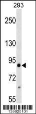 Anti-ITGB2 Rabbit Polyclonal Antibody (HRP (Horseradish Peroxidase))