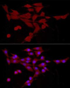 Anti-CAMKK2 Rabbit Polyclonal Antibody