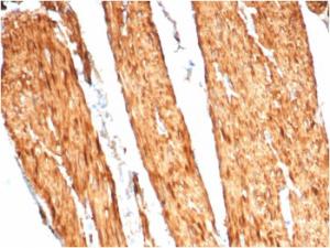 Immunohistochemical analysis of formalin-fixed, paraffin-embedded human colon tissue using Anti-Caldesmon Antibody [CALD1/7024R]