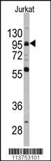 Anti-CD19 Rabbit Polyclonal Antibody