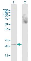 Anti-CRYAB Mouse Polyclonal Antibody