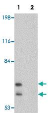 Anti-PICALM Rabbit Polyclonal Antibody