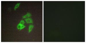 Immunofluorescence analysis of A549 cells using Anti-ST14 Antibody. The right hand panel represents a negative control, where the Antibody was pre-incubated with the immunising peptide