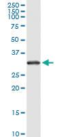 Anti-RPS2 Mouse Monoclonal Antibody [clone: 3G6]