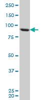 Anti-TARS Mouse Monoclonal Antibody [clone: 1A9]