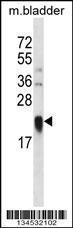 Anti-LY86 Rabbit Polyclonal Antibody (AP (Alkaline Phosphatase))