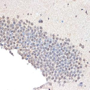 Immunohistochemistry analysis of paraffin-embedded mouse brain using Anti-CoREST Antibody [ARC2044] (A307585) at a dilution of 1:100 (40x lens). Perform microwave antigen retrieval with 10 mM Tris/EDTA buffer pH 9.0 before commencing with IHC staining protocol.