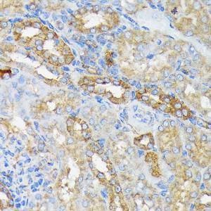 Anti-RALBP1 antibody