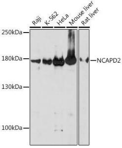 Western blot analysis of extracts of various cell lines, using Anti-NCAPD2 Antibody (A305867) at 1:1,000 dilution