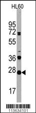 Anti-CSAD Rabbit Polyclonal Antibody