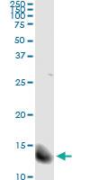 Anti-FABP4 Mouse Monoclonal Antibody [clone: 2H3-1G10]