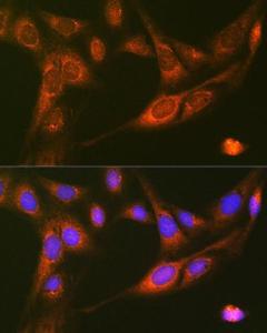 Anti-RALBP1 antibody