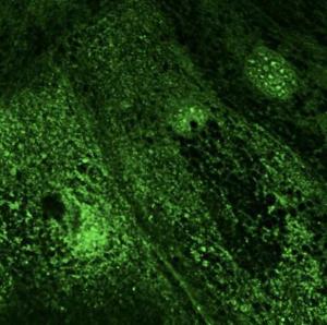 Primary RPE cells stained with Anti-RAB28 Antibody at a 1:100 dilution